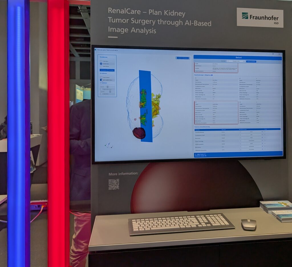 Hier ist das Nierenbild in Rot zu sehen. Dabei wieder ein Monitor mit vielen Parametern.